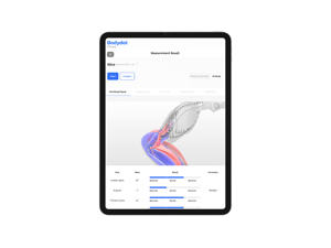 Bodydot BDF1000 Analyseur de santé corporelle intelligent alimenté par l'IA, cadre flexible en alliage d'aluminium, suivi de posture corporelle complète non pliable - Product Image 5