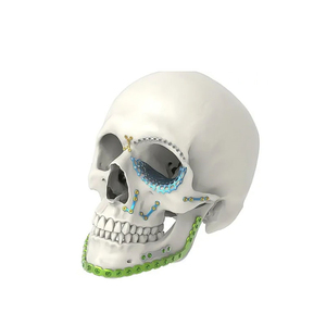 Plaques et vis de neurochirurgie maxillo-faciale de conception internationale de pointe, en acier inoxydable, hypoallergéniques, autoclavables - Product Image 3
