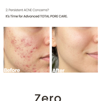 Kore cilt bakımı PDRN Traneksamik Asit Serumu Altın Peptit koyu leke hiperpigmentasyon AHA Günlük Peeling Derin Nemlendirme