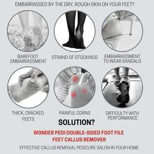 Removedor de Callos para Pies, Seguro y Efectivo para Uso Diario, con Protección de Seguridad Integrada, Diseño Duradero - SHEARS BEAUTY SB-FCR-709 para Uso Doméstico - Product Image 3