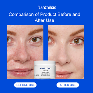 Baume Nettoyant Visage Non Comédogène <span class=keywords><strong>Sans</strong></span> Parfum OEM, Complexe de Céramides, Huile de Jojoba, Hydratant, Nourrissant, <span class=keywords><strong>Démaquillant</strong></span> - Product Image 2