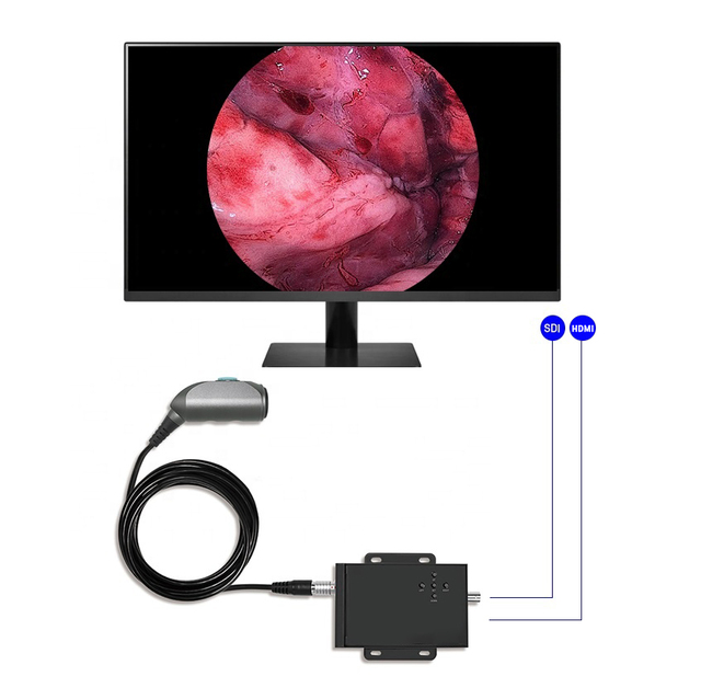 HD HDMI SDI Handle Medical ENT Endoscopy Camera Portable Clinic VET Endoscopy Unit for Rigid Camera System