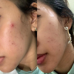 Mineral Botanica Ceramide <b>Serum</b> 20ml OEM ODM Private Label for Face with Vitamin B5 and Ceramide Hydrating Face <b>Serum</b> for Dry - Product Image 4