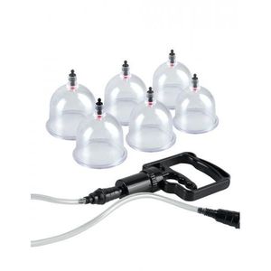 Fetish Fantasy Beginner's <b>Cupping</b> Set 6-Piece Kit - Product Image 1