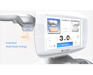 ระบบอุปกรณ์อัลตร้าฟอร์เมอร์ 3-ไฮฟู - Product Image 2