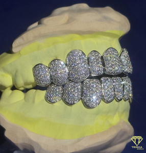 Grillz personnalisés faits à la main en opale, moissanite et diamant, en argent 925, bijoux dentaires sertis de pierres, livraison rapide - Product Image 2