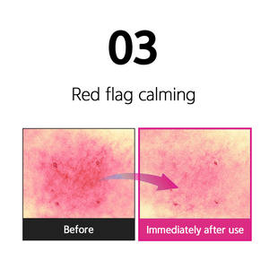 Crema Facial y Corporal con Niacinamida para el Cuidado de la Piel con Melasma, Crema Coreana para el Cuidado de la Piel, Tónico, Suero, Cosméticos Faciales, 20 kg - Product Image 5