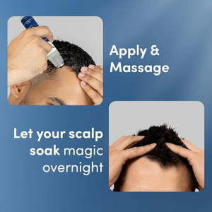Sets de Cuidado Capilar, Suero Avanzado con Romero en Roll-On para el Tratamiento del Cuero Cabelludo, Promueve el Crecimiento, Previene la Caída del Cabello, Tónico con Extracto - Product Image 4