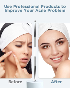 Stainless Steel Pimple <b>Extractor</b> Customizable Packaging Latest Design KANEKA ENTERPRISES High Quality Face <b>Blackhead</b> Remover - Product Image 5