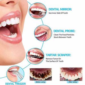 กระจกตรวจฟันแบบมีด้ามจับลายกันลื่น สีเงิน ยี่ห้อ Morje Surgical Dental  ชนิดใช้มือ  คลาส II ได้รับการรับรองมาตรฐาน CE  เครื่องมือผ่าตัด - Product Image 5