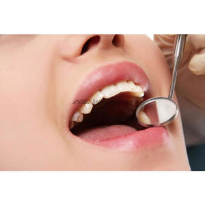 Juego de herramientas manuales de acero inoxidable para limpieza dental: raspador de sarro, pinzas dentales, espejo bucal, kit quirúrgico dental para consultorio. - Product Image 5