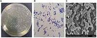 Bifidobacterium Bifidum Poudre Blanche Santé Intestinale Infantile Conditions Gastro-intestinales Allergiques et Inflammatoires Pédiatriques 100 Milliards