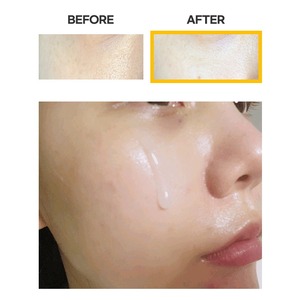 เซรั่มบำรุงผิวหน้าเกาหลี K-Beauty 30 มล. วิตามินซี ไนอะซินาไมด์ อาร์บูติน แอมพูล ช่วยให้ผิวขาวกระจ่างใส ลดเลือนริ้วรอย และเพิ่มความชุ่มชื้น - Product Image 3