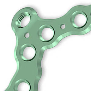 Plaque de radius distal en titane, instrument chirurgical orthopédique, couleur verte, manuel, classe I - Product Image 3