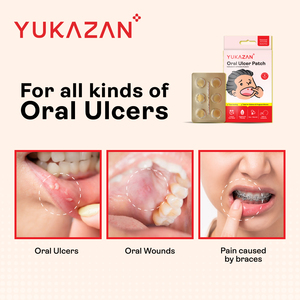 Patchs Yukazan pour ulcères buccaux, 6 unités, Meilleure vente en Malaisie, Qualité supérieure garantie par le meilleur fournisseur, Soulagement de la douleur et soin des plaies buccales - Product Image 5