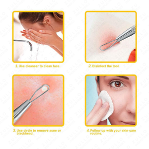 Ensemble de 2 outils professionnels en acier inoxydable pour éliminer les points noirs et l'acné, extracteur de boutons pour le soin de la peau du visage - Product Image 4