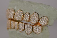 Grillz de Moissanita de Calidad Premium, Hechos a Medida, con Brillo Intenso y Diseño Seguro, Disponibles al Mejor Precio del Mercado