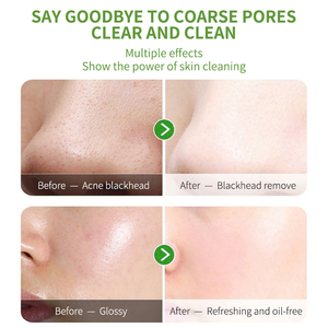 Bán Sỉ Mặt Nạ Đất Sét Tẩy Mụn Đầu Đen Mặt Nạ Đất Sét Làm Sạch Sâu Kiểm Soát Dầu Rắn Trà Xanh Hữu Cơ Thuần Chay Mặt Nạ Đất Sét Làm Sạch Bùn - Product Image 5