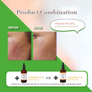 Elionsrx 30% Salix Acid B.H.A Body Acne Skin Peeling Serum <b>Blackheads</b> Exfoliator Oily Skin Pore Shrinking Gel for Face - Product Image 4