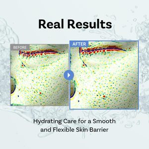 [SAMPLE] Apothe Squal-Tox Booster Spray 100ml Hidratante, Humectante, Calmante, Iluminador, Reforzador de la Barrera Cutánea, para Mujeres, Todo Tipo de Piel - Product Image 2