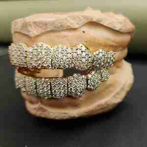 Juego de Grillz de Diamantes Personalizados DOPE JEWELLS, Chapado en Oro de Ley 925, Engaste Pavé, Joyería Hip Hop para Hombre, 10.78 CT - Product Image 2