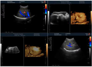 Échographe portable couleur Doppler, appareil d'échographie numérique complet, système de diagnostic ultrasonore 3D/4D - Product Image 4