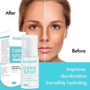 नए उत्पादों 2022 चीनी Pimples लोशन और क्रीम कार्बनिक त्वचा Whitening चेहरा विरोधी मुँहासे Pimples अंधेरे स्थान को हटाने क्रीम