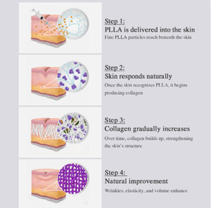 Solution PLLA 200 rajeunissante pour la peau, longue durée (24 mois), stimule le collagène naturel pour un aspect jeune et un lifting du visage - Product Image 3