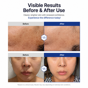 Suero premium AESTHEIN K-Beauty 50ml con niacinamida y ácido tranexámico coreano para el cuidado de manchas oscuras e hiperpigmentación. - Product Image 3