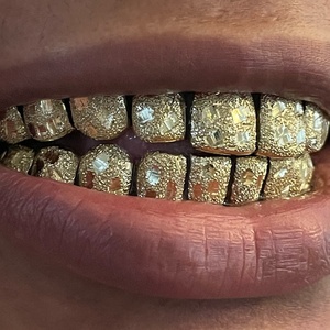 AMBER JEWELS Grillz dentaire en argent 925 avec strass en cristal taille brillant, style Hiphop de luxe, unisexe, pour usage quotidien, cadeau - Product Image 2
