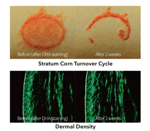 Ampolla Rejuvenecedora REJURAN 50ml con c-PDRN y Ácido Hialurónico, Suero Antienvejecimiento para Rejuvenecimiento de la Piel y Producción de Colágeno - Product Image 2