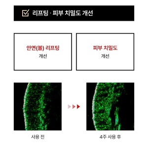 Set de Cuidado de la Piel Coreano Intensivo K-Beauty, Crema de 120 ml con Complejo Negro, Niacinamida, Adenosina, Antienvejecimiento, Iluminadora, para Todo Tipo de Piel - Product Image 4