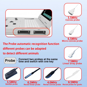 Mesin <span class=keywords><strong>Ultrasound</strong></span> portabel kualitas tinggi mesin dasar Laptop BW pemindai <span class=keywords><strong>Ultrasound</strong></span> peralatan rumah sakit mesin <span class=keywords><strong>Ultrasound</strong></span> untuk manusia - Product Image 3
