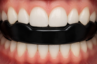 DUMELA INTERNATIONAL Protège-dents en silicone personnalisé pour adultes unisexe, protection buccale pour la boxe, impression personnalisée pour la boxe