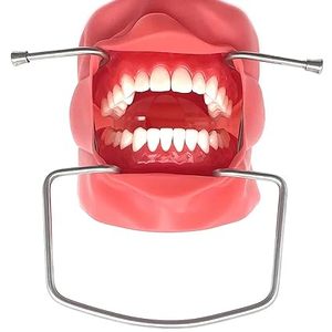 Retractor Bucal y Labial de Grado Profesional para Exámenes Orales y Procedimientos Quirúrgicos, Aprobado por ISO - Product Image 4