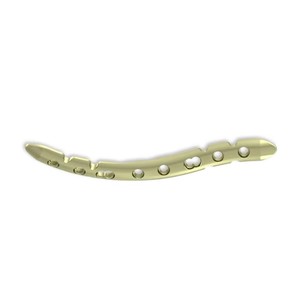 Sistema de Implantes Ortopédicos Profesionales para Fijación de Fracturas y Procedimientos Reconstructivos - Product Image 5