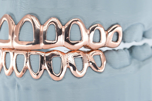 Personalizado hecho a mano blanco amarillo oro y plata cara abierta diseño clásico superior e inferior conjunto de dientes dentales - Product Image 6