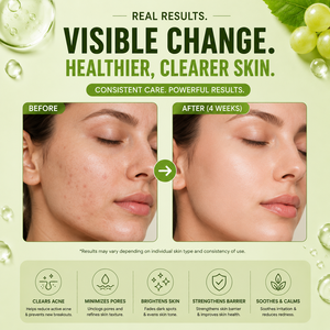 Manufacturer Supply Acne Control <b>Face</b> Serum with Salicylic Acid and Niacinamide - Product Image 6