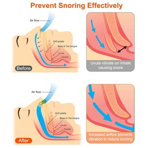 4 Pezzi Clip Nasale Magnetico Confortevole e Riutilizzabile, Dispositivo Anti-Russamento per Uomini e Donne, Ausilio per il Sonno - Product Image 4