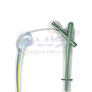 Implante ortopédico de clavo entrelazado de aleación de titanio para implantes proximales, materiales intervencionistas de Blush Surgical - Product Image 6