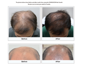 Suero Capilar OEM PDRN con Niacinamida para Hombres, Tratamiento Anticaída, Etiqueta Privada, 40ml, Estimulante del Crecimiento del Cabello Fino - Product Image 5