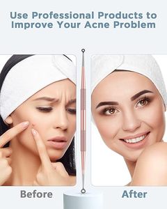 Extracteur de points noirs et de boutons en acier inoxydable durable pour l'élimination de l'acné, des comédons, des imperfections, des points blancs et des boutons - Product Image 5