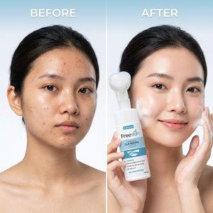 Espuma Limpiadora Facial de Alta Calidad con pH Balanceado, Limpieza Profunda, Hidratante, No Reseca, Fórmula Antiacné, Empaque Personalizado - Product Image 1