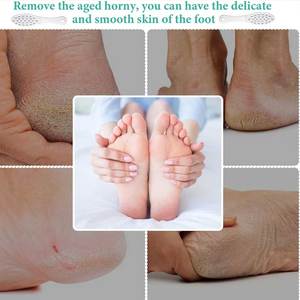 Removedor de Callos Portátil para Uso Doméstico, Ergonómico con Mango de Fácil Agarre, Calidad Duradera Grado A+ - SHEARS BEAUTY - Product Image 5