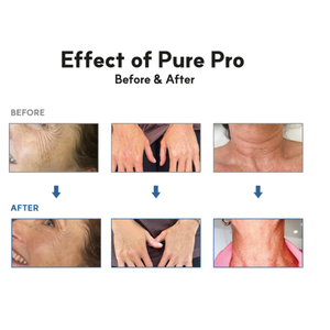 Ampolla de Ácido Hialurónico Polinucleótido Pure Pro, Potenciador de la Piel, Hidratación, Reafirmación, Cuidado Luminoso para Rostro, Cuello y Manos - Product Image 3