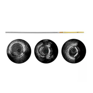 Catéter Avanzado de Grado Industrial VOLCANO VISIONS PV .014P RX Digital IVUS de 150 cm para Procedimientos de Imagenología de Arterias Periféricas - Product Image 6