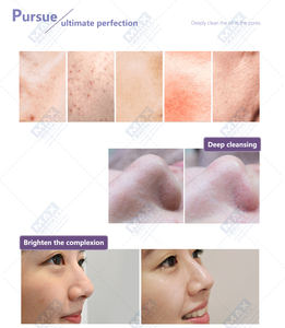 Solución de Suero Líquido, Consejos para la Máquina Facial Hydra Beauty - Product Image 2