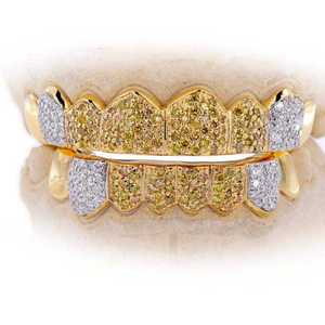 Grillz plaqué or jaune massif avec pierres de moissanite, design Iced Out, taille brillant rond, ensemble personnalisé pour dents supérieures et inférieures - Product Image 1