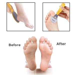 15-in-1 Professional Pedicure Tools Set Stainless Steel <b>Foot</b> <b>Care</b> <b>Kit</b> with Callus File Callus Shaver Cuticle Scissors <b>Foot</b> Rasp - Product Image 2