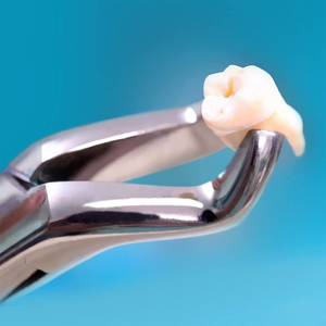 Forceps d'extraction dentaire de qualité supérieure, grade O.R. # 150 instruments pour les premiers molaires supérieurs, les incisives et les racines - Product Image 2